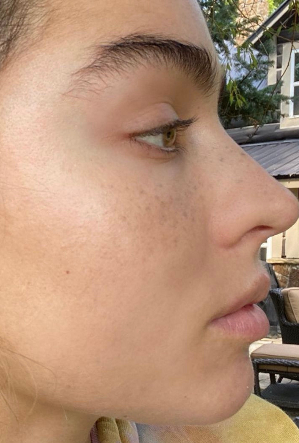 Close-up side profile of the same woman after using IMARAÏS BEAUTY Clarity gummies, showing visibly clearer, smoother skin with reduced redness and blemishes.