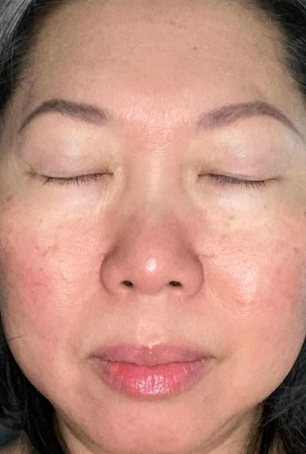 Close-up of the same woman’s face after using IMARAÏS BEAUTY DePuff gummies, showing reduced under-eye puffiness, smoother skin texture, and a more refreshed, even complexion.