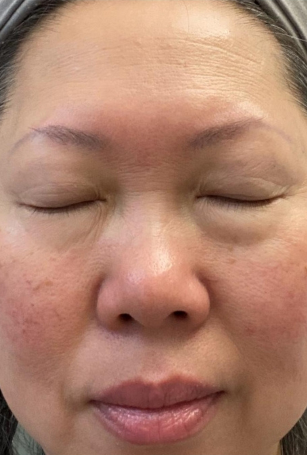 Close-up of a woman’s face with eyes closed, showing visible under-eye puffiness, fine lines, and uneven skin tone before using IMARAÏS BEAUTY DePuff gummies.