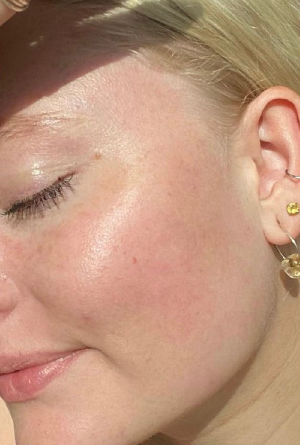 Close-up of the same woman’s cheek and jawline after using IMARAÏS BEAUTY GLOW gummies, revealing visibly smoother, brighter, and more even-toned skin with a natural glow.